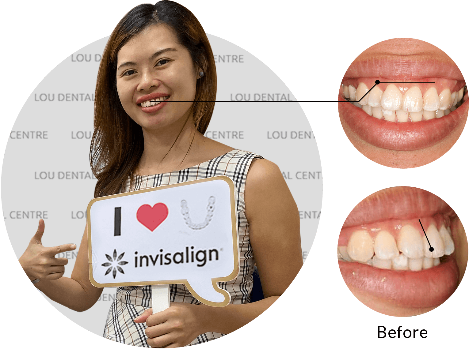 Claire Lim smile with invisalign treatment