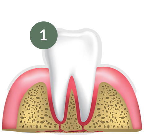 Healthy Gums and Tooth Johor Bahru (JB) | Dental Clinic Johor Bahru (JB) | Children Friendly Dentist Johor Bahru (JB) | Invisalign Johor Bahru (JB)