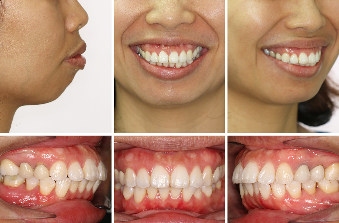 Our Happy Client • Before