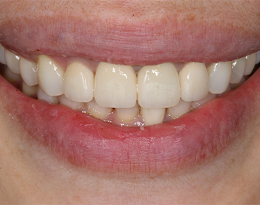 Our Happy Client • After